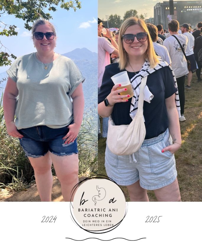 Vorher Nachher Bild meiner Abnehmreise Bariatric.Ani Coaching - Vorher Nachher Bild meiner Abnehmreise